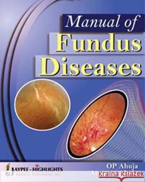 Manual of Fundus Diseases  9788184489644 Jaypee Brothers Medical Publishers