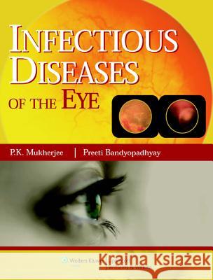 Infectious Diseases of the Eyes P K Mukherjee 9788184731989 0