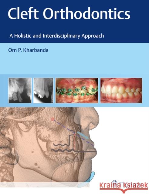 Cleft Orthodontics: A Holistic and Interdisciplinary Approach Kharbanda, Om P. 9788194857082 Thieme, Stuttgart