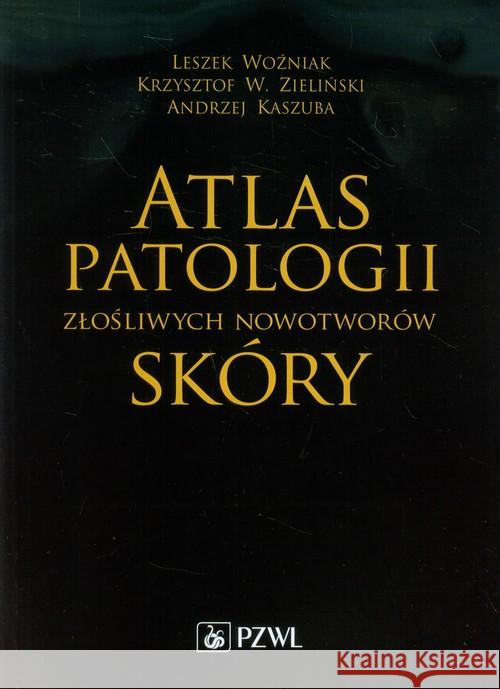 Atlas patologii złośliwych nowotworów skóry Woźniak Leszek Zieliński Krzysztof W. Kaszuba Andrzej 9788320047257 PZWL