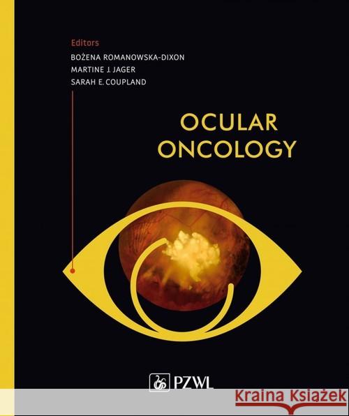 Ocular oncology Romanowska-Dixon 	Bożena Jager Martine J. Coupland Sarah E. 9788320059076