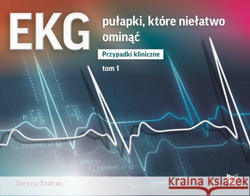 EKG pułapki, które niełatwo ominąć Przypadki kliniczne Tom 1 Szafran Bartosz 9788366097605