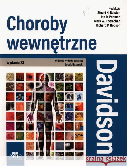 Davidson Choroby wewnętrzne  Tom 3 Ralston S.H. Strachan M.W.J. Penman 9788366310865 Edra Urban & Partner
