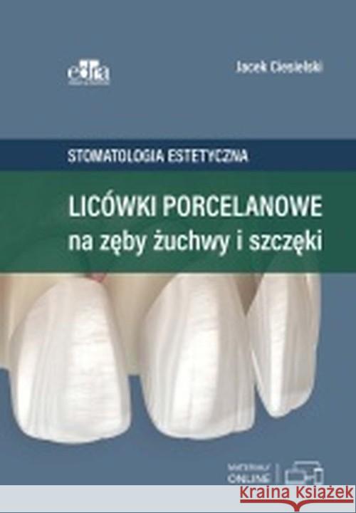 Licówki porcelanowe na zęby żuchwy i szczęki Ciesielski J. 9788366548077