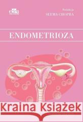 Endometrioza S Chopra 9788366960091
