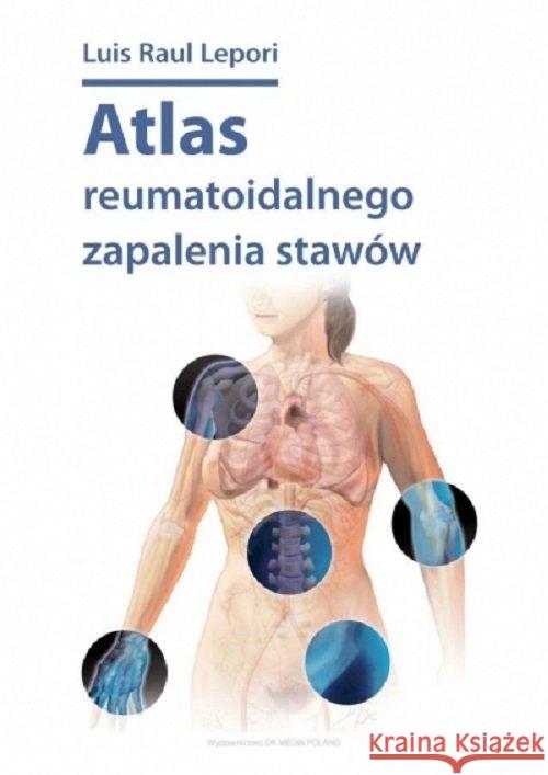 Atlas reumatoidalnego zapalenia stawów Lepori Luis Raul 9788395299117 DK MEDIA
