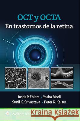 Oct Y Octa En Trastornos de la Retina Ehlers, Justis P. 9788418563126 LWW