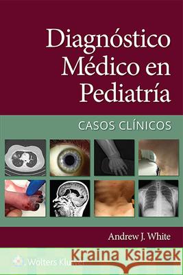 Diagnóstico Médico En Pediatría. Casos Clínicos White, Andrew 9788418892615 Ovid Technologies