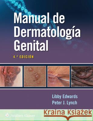 Manual de dermatología genital Elizabeth Edwards, Peter Lynch 9788419284877