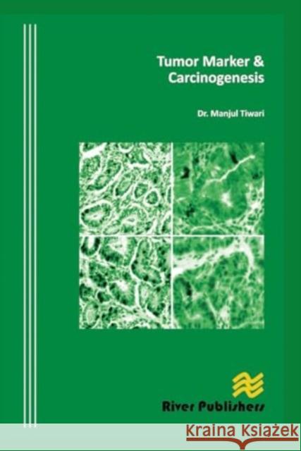 Tumor Marker and Carcinogenesis Manjul Tiwari 9788770045223 River Publishers