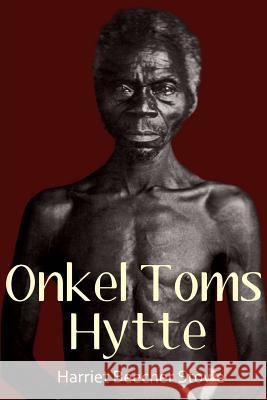 Onkel Toms Hytte - light Benny Kloth-Jørgensen 9788793381087