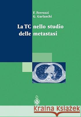 La Tc Nello Studio Delle Metastasi F. Ferrozzi G. Garlaschi P. Bassi 9788847000322 Not Avail