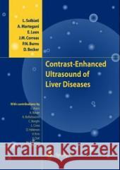 Contrast-Enhanced Ultrasound of Liver Diseases L. Solbiati Luigi Solbiati Alberto Martegani 9788847002074 Springer