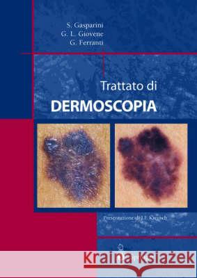 Trattato Di Dermoscopia Gasparini, Saturnino 9788847002272 Springer