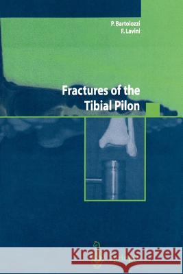 Fractures of the Tibial Pilon P. Bartolozzi F. Lavini Group Logo 9788847002487 Springer