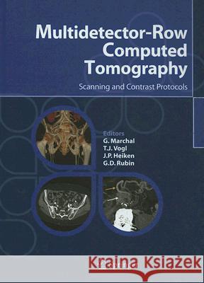 Multidetector-Row Computed Tomography: Scanning and Contrast Protocols Marchal, G. 9788847003057 Springer