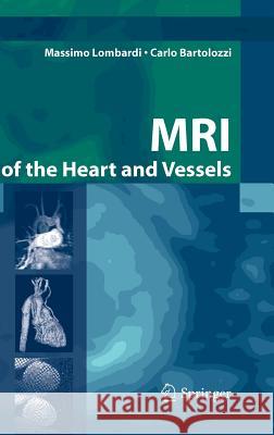 MRI of the Heart and Vessels Massimo Lombardi Carlo Bartolozzi Massimo Lombardi 9788847003064