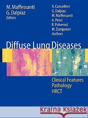 Diffuse Lung Diseases: Clinical Features, Pathology, Hrct Polverosi, R. 9788847004290 Springer