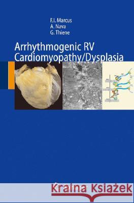 Arrhythmogenic RV Cardiomyopathy/Dysplasia: Recent Advances Marcus, Frank I. 9788847004894 Springer