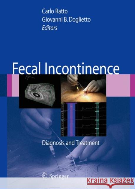 Fecal Incontinence: Diagnosis and Treatment Lowry, A. C. 9788847006379 Springer