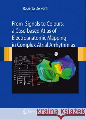 From Signals to Colours: A Case-Based Atlas of Electroanatomic Mapping in Complex Atrial Arrhythmias De Ponti, Roberto 9788847006485 Springer