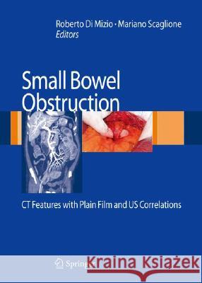 Small-Bowel Obstruction: CT Features with Plain Film and US Correlations Di Mizio, Roberto 9788847006669 Springer