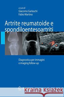 Artrite Reumatoide E Spondiloentesoartriti: Diagnostica Per Immagini Ed Imaging Follow-Up Garlaschi, Giacomo 9788847006850 Springer