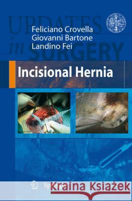 Incisional Hernia Feliciano Crovella Giovanni Bartone Landino Fei 9788847007215 Not Avail