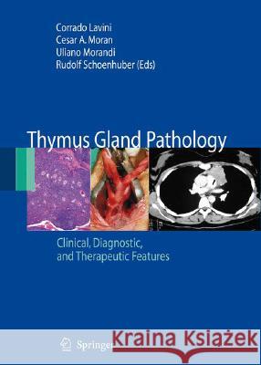 Thymus Gland Pathology: Clinical, Diagnostic and Therapeutic Features Lavini, Corrado 9788847008274 SPRINGER VERLAG, ITALY