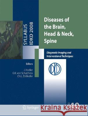 Diseases of the Brain, Head & Neck, Spine: Diagnostic Imaging and Interventional Techniques Schulthess, Gustav K. 9788847008397 SPRINGER VERLAG, ITALY