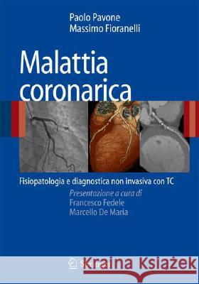 Malattia Coronarica: Fisiopatologia E Diagnostica Non Invasiva Con Tc Pavone, Paolo 9788847008496 Springer