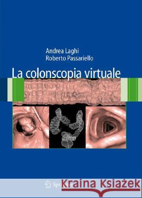 La Colonscopia Virtuale Laghi, Andrea 9788847010666 Springer