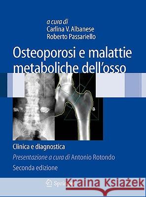 Osteoporosi E Malattie Metaboliche Dell'osso: Clinica E Diagnostica Albanese, Carlina V. 9788847013568 Springer