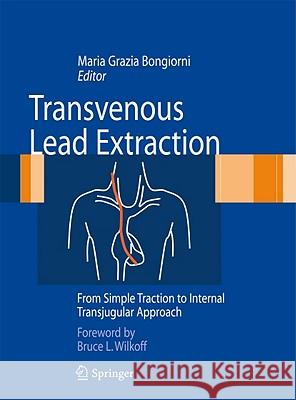 Transvenous Lead Extraction: From Simple Traction to Internal Transjugular Approach Bongiorni, Maria Grazia 9788847014657 Springer