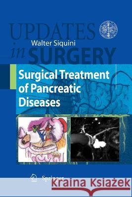 Surgical Treatment of Pancreatic Diseases Walter Siquini 9788847015654 Not Avail