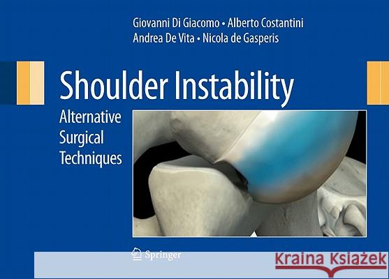 Shoulder Instability: Alternative Surgical Techniques Di Giacomo, Giovanni 9788847020344