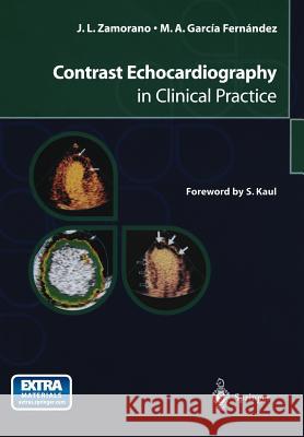 Contrast Echocardiography in Clinical Practice S. Kaul Jose Luis Zamorano Miguel A. Garcia Fernandez 9788847021747 Springer Verlag