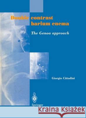 Double Contrast Barium Enema: The Genoa Approach Margulis, A. R. 9788847022195 Springer Verlag