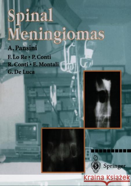 Spinal Meningiomas A. Pansini F. L P. Conti 9788847022621 Springer