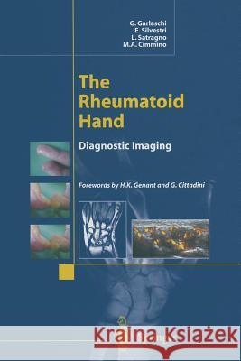 The Rheumatoid Hand: Diagnostic Imaging Garlaschi, G. 9788847022683