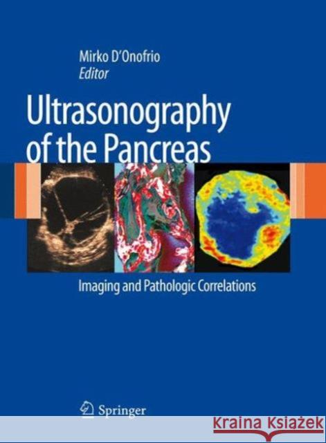 Ultrasonography of the Pancreas: Imaging and Pathologic Correlations D'Onofrio, Mirko 9788847023789 Springer, Berlin