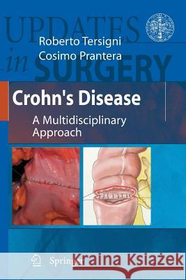 Crohn's Disease: A Multidisciplinary Approach Tersigni, Roberto 9788847025158 Springer