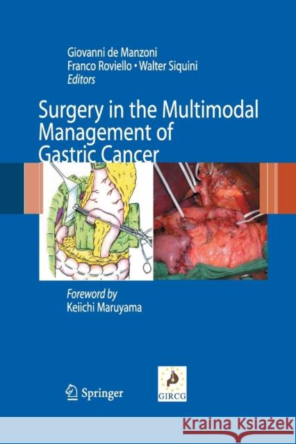 Surgery in the Multimodal Management of Gastric Cancer Giovanni D Franco Roviello Walter Siquini 9788847039155 Springer