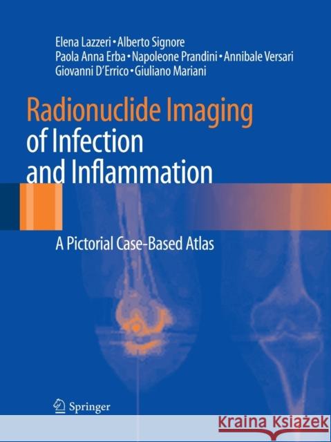 Radionuclide Imaging of Infection and Inflammation: A Pictorial Case-Based Atlas Lazzeri, Elena 9788847039278 Springer