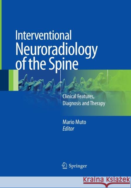 Interventional Neuroradiology of the Spine: Clinical Features, Diagnosis and Therapy Muto, Mario 9788847039308