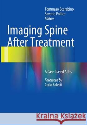 Imaging Spine After Treatment: A Case-Based Atlas Scarabino, Tommaso 9788847039407