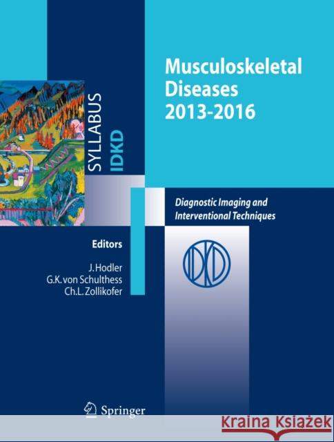 Musculoskeletal Diseases 2013-2016: Diagnostic Imaging Hodler, J. 9788847052918 Springer