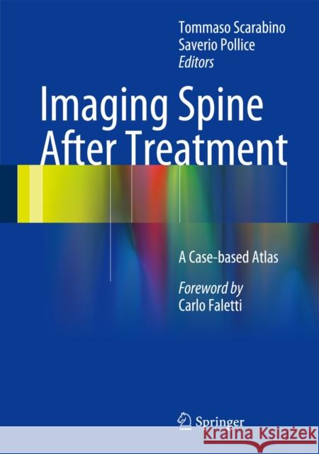 Imaging Spine After Treatment: A Case-Based Atlas Scarabino, Tommaso 9788847053908 Springer Verlag