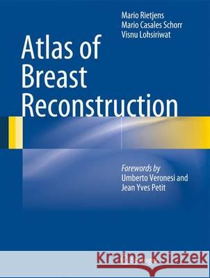 Atlas of Breast Reconstruction Mario Rietjens Mario Schorr 9788847055186