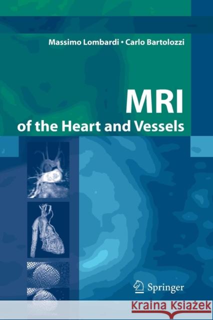 MRI of the Heart and Vessels Massimo Lombardi M. Walker L. Donato 9788847055469 Springer